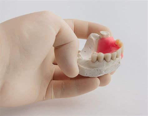 If the denture seems to slide easily you should stabilize the palate first. Can I Repair or Reline My Own Dentures? - The Denture and Implant Centre