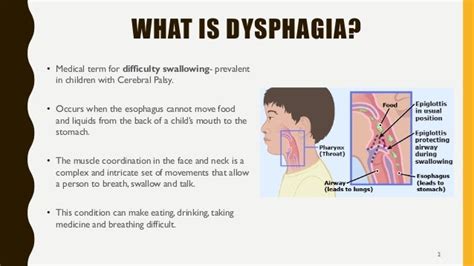 Dysphagia Aid Presentation