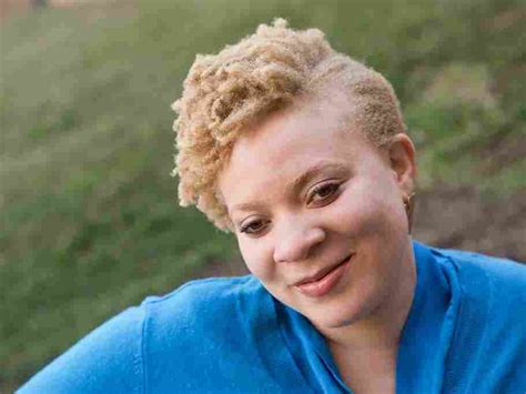 People Of Color With Albinism Ask Where Do I Belong Code Switch Npr