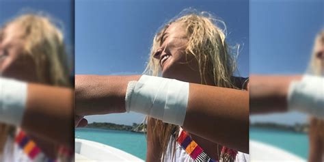 Instagram Model 19 Bitten By Shark While Taking Photos In Bahamas