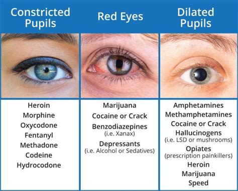 Image Result For Pupil Size Chart Drugs Pharm