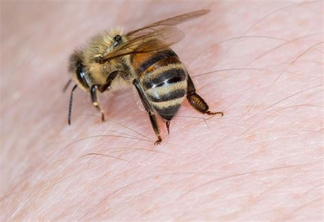 8 Effective Home Remedies To Treat Bee Stings Naturally