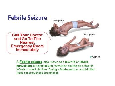 A seizure usually affects how a person appears or acts for a short time. Febrile Seizure (Febrile Convulsion). Causes, symptoms ...