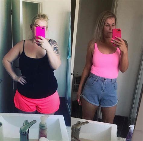 Katie Lost 47 Kgs 10 Months After Weight Loss Surgery In Thailand