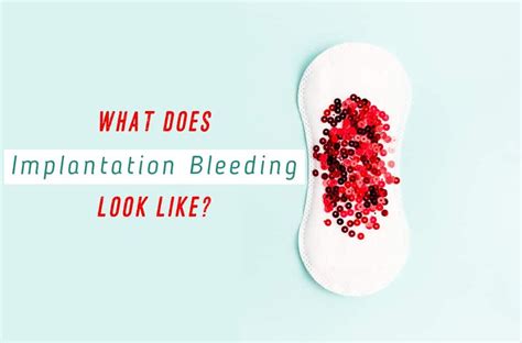 Blood Clots During Early Pregnancy Bleeding Vaginal Bleeding And Blood