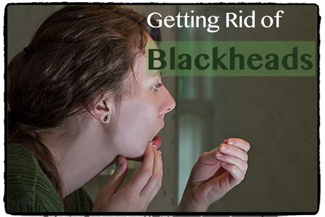 Press on the extractor using light pressure to take the blackheads out from the loosened pores. How to Get Rid of Blackheads on Nose: Ten Simple Tips ...