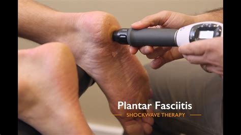 Shockwave Therapy Plantar Fasciitis Youtube