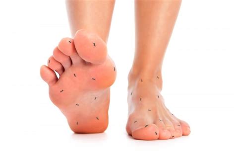 Diabetic Neuropathy Is A Type Of Nerve Damage That Can Occur In