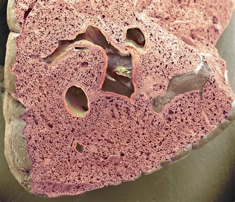 Lung Tissue Sem Stock Image C0124902 Science Photo Library