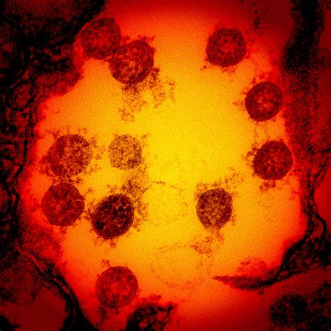 The Coronavirus Is Still Mutating But Will That Matter ‘we Need To
