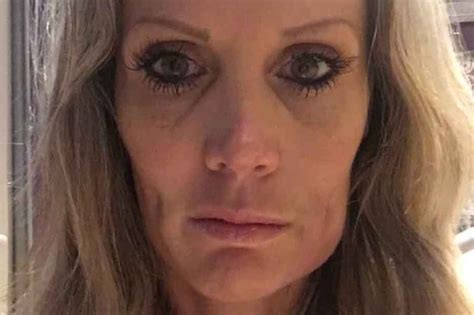 Mum Spent £1300 Having Holes Cut In Her Cheeks Because She Wanted