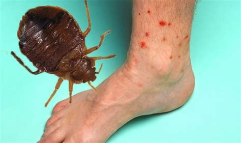 Bed Bugs Are Your Bites From Bed Bugs How To Identify Bed Bug Bites