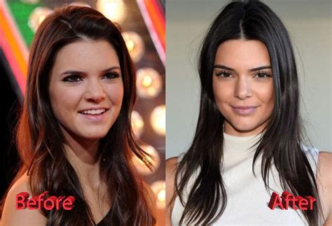 Kendall Jenner Denies The Obvious Truth