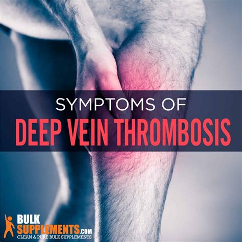 Deep Vein Thrombosis Symptoms Causes Treatment