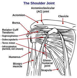 If one of your rotator cuff muscles has torn tendon. Shoulder