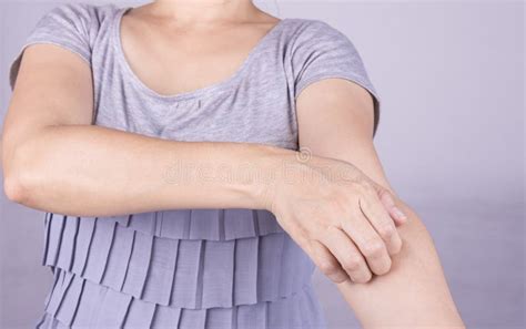 Scratch The Itch Stock Image Image Of Eczema Bite Pain 64399789