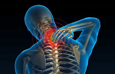 Neck Pain And Stiffness What Causes And What To Do