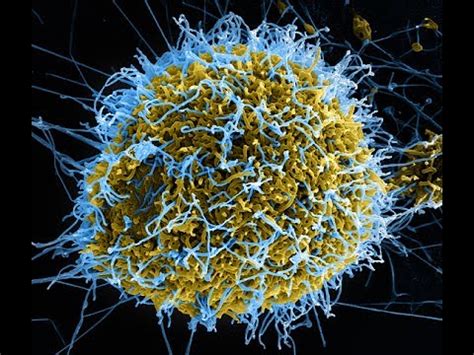 Two new ebola cases have been confirmed in sierra leone, which indicates that the deadly virus is not controlled and is now in its second generation, the world health organization (who) said. The 2013-2016 Ebola epidemic - YouTube