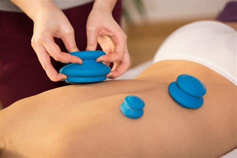 Cupping Therapy & Treatment in Beverly & Newburyport