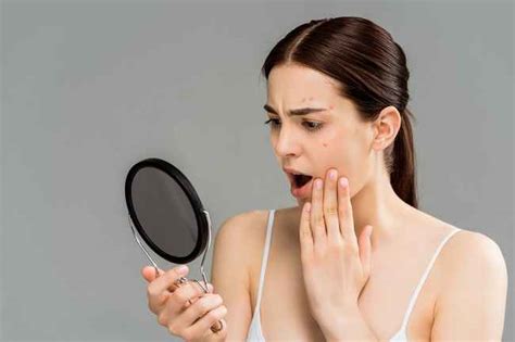 4 masalah kulit ini bisa menjadi efek stres pada kulit alodokter