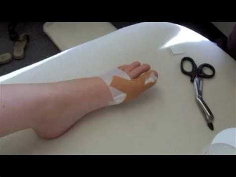 To correct this anatomical abnormality, use arch supports that are easily available at local pharmacies and do not require a prescription. Prevent and treat early Bunions with taping. | Bunion ...