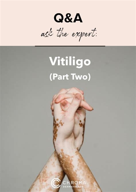 Ask The Expert Vitiligo Part 2