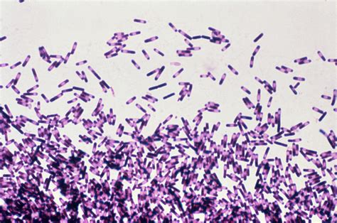 Clostridium Difficile Bacteria Photograph By Cdcscience Photo Library