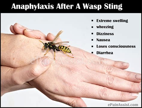 Wasp Stingsymptomstreatmenthome Remedyherbal Remedy