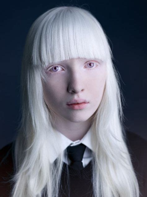 200 Best Albino Images Albino Albinism Albino Model