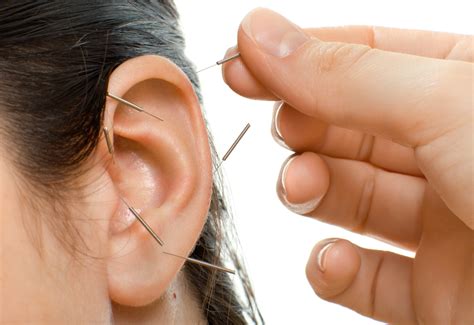 Acupuncture For The Ears Discoverhealth