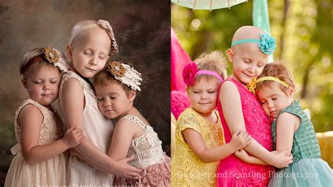 Young Girls Battling Cancer Appear In Stunning Beforeafter Images