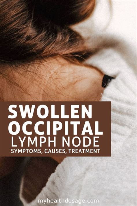 Swollen Occipital Lymph Nodes Causes Symptoms And Tre Vrogue Co