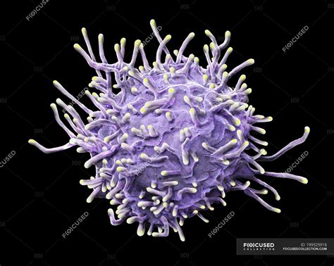 Colored Scanning Electron Micrograph Of Activated T Lymphocyte From