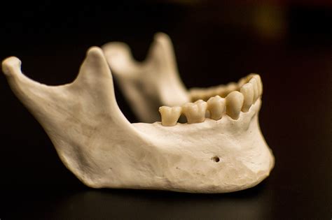 Human Lower Jaw Bone Anatomy