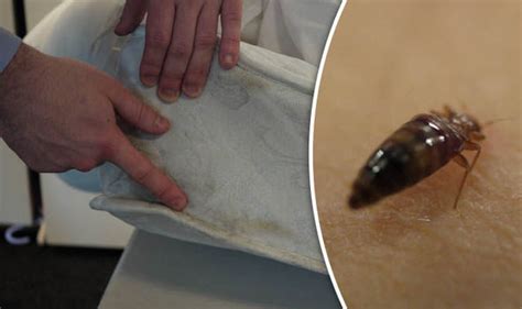Bed Bugs On The Rampage As Pest Controllers Report Double Call Outs
