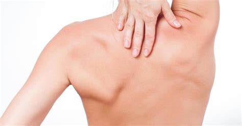 Shoulder Blade Pain Causes Treatment And Prevention