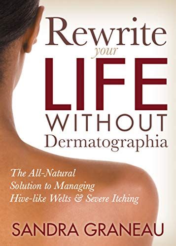 Jp Rewrite Your Life Without Dermatographia The All Natural