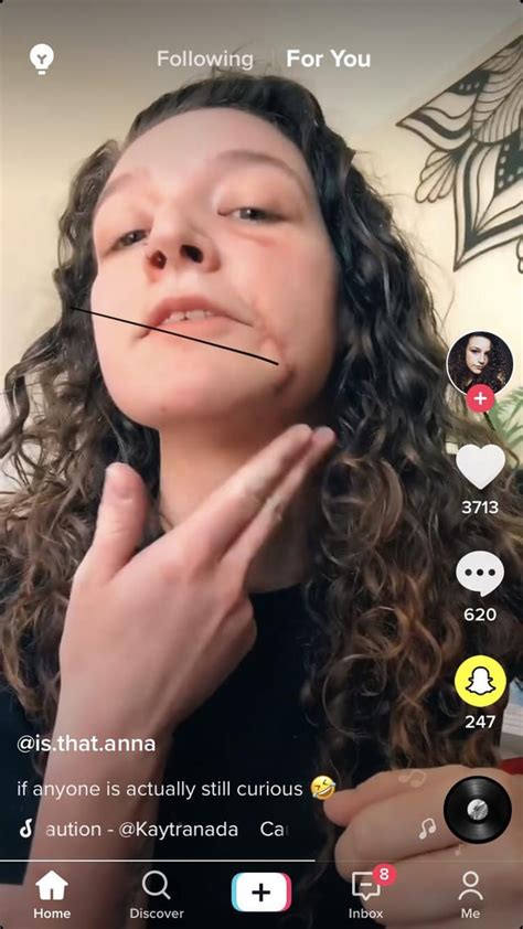 A Woman On Tik Tok Explaining Her Scars They Were From A Pit Bull She