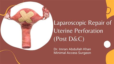 Laparoscopic Uterine Perforation Repair Post Dandc Uterus Surgery Dr