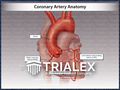 Coronary Artery Anatomy Trialexhibits Inc