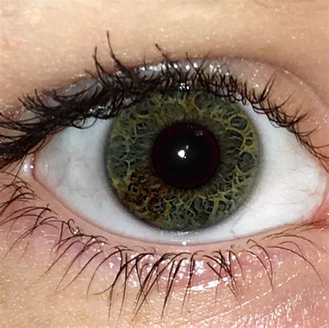 I Have A Small Amount Of Sectoral Heterochromia In My Right Eye Plus A Kind Of Interesting Eye