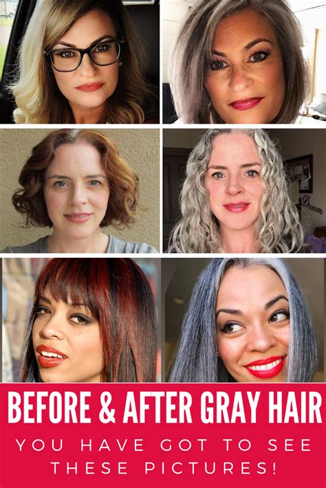 30 Gray Hair Before And After Pix That Will Blow Your Mind Gray Hair Growing Out Grey Hair