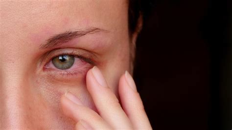 8 Signs Of Eye Trauma Retina Specialists Retinal Ophthalmologists