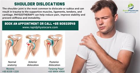 A Dislocated Shoulder Is An Injury In Which Your Upper Arm Bone Pops