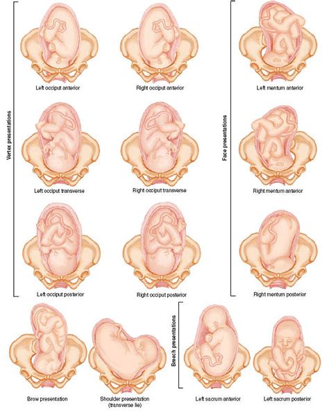 Fetal Positions Midwifery Midwifery Student Pediatric Nursing
