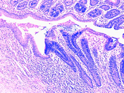 Gastroesophageal Junction Histology Labeled
