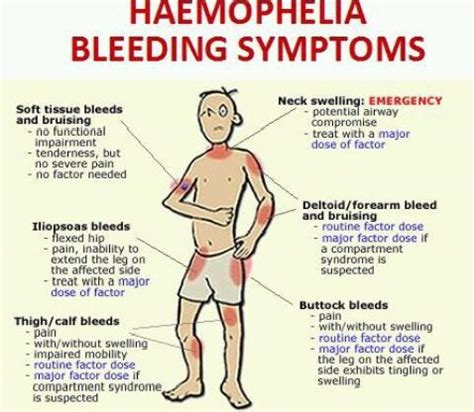 Citiți mai multe despre simptomele, diagnosticul, tratamentul, complicațiile, cauzele și prognoza. Heamophilia: The bleeding disorder |Trustmedi