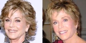 More information about jane fonda: Jane Fonda Plastic Surgery - Plastic Surgery Log