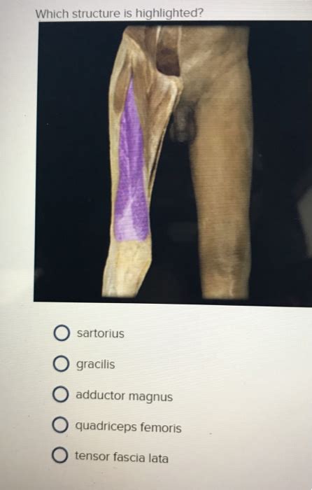 Which muscle is highlighted below. Solved: Which Structure Is Highlighted? O Rectus Abdominis ...