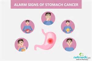 If it is diagnosed at an early stage then an operation to remove the cancer gives some chance of a cure. Gastric Cancer: Causes, Symptoms and Treatment | Netmeds